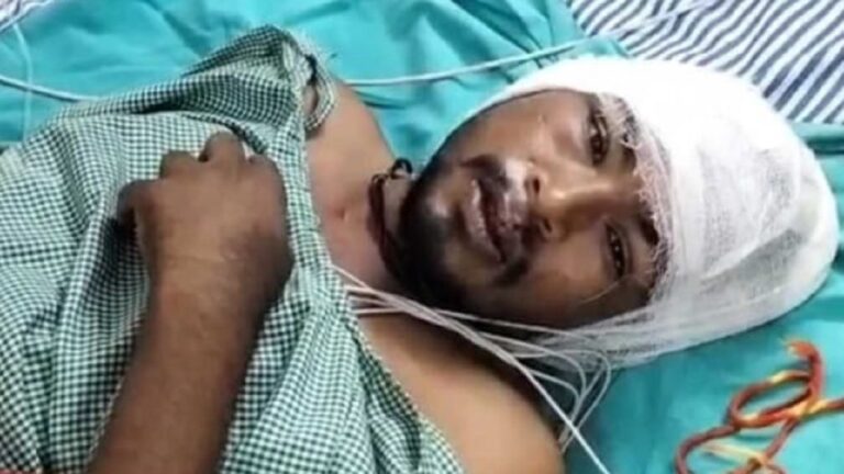 तुमगांव में युवक पर हथौड़ी से हमला, आरोपी 48 घंटे बाद भी फरार